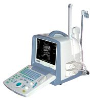 Sell Digital Ultrasound Scanner (  BW8S  )