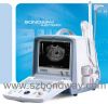 Sell Portable Digital Ultrasound Scanner(BW8T)