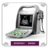Sell  Full Digital Ultrasound Imaging System
