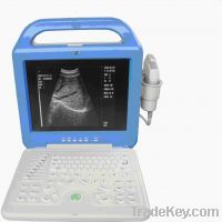 Sell Laptop Ultrasound Scanner