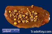 cattle  gallstone