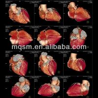 medical x-ray film