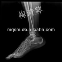 supply medical blue sensitive x-ray film