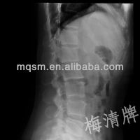 manufacturer of medical inkjet/laser  x-ray film