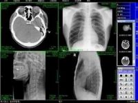 Radiologic Image Workstation