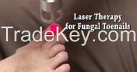 Nail Fungus laser with 810nm/980nm diode laser