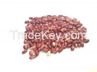 Ethiopian Red speckled kidney bean