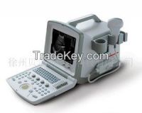 Full digital ultrasound scanner 830