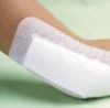 Adhesive Wound Dressings