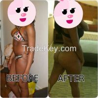 hydrogel butts augmentation and kitts injection for sale