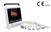 Portable Ultrasound Scanner