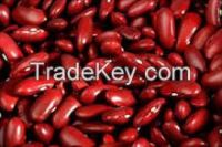 Red/White/Black Kidney Beans for sales