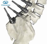 Orthopedic pedicle screw rod fixation, multi axial pedicle screw