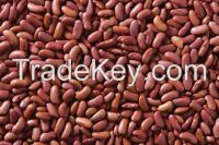 Kidney Beans, Red Kidney/ White Kidney/Alubia/ Chali/ Sira/Cannellini Beans