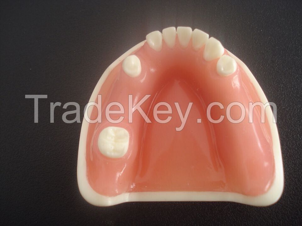 dental implant model with soft gingiva for practice