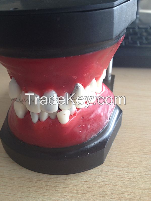 Orthodontic Models Ligature Tying Training Typodont model