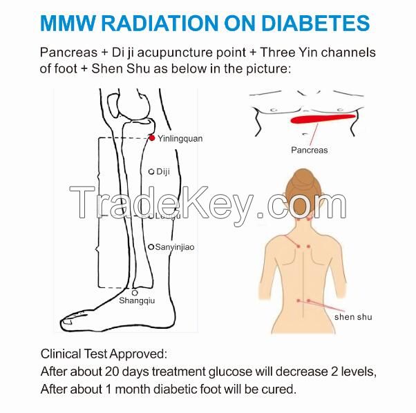 Factory offer millimeter wave medical instrument for curing diabetes, high blood glucose, tumors, pain relief