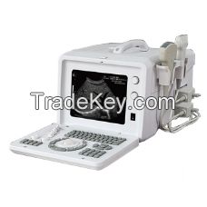 2016 Portable Ultrasound Machine EXRH-300A for Sale