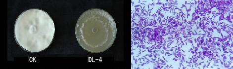 Microbial inoculant