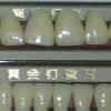 Gold Nail porcelain teeth