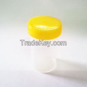 Urine Container 60 mL - Non Sterile - Yellow Cap