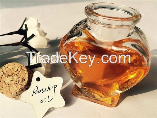 Bulk pure rose hips seed oil,free sample manufacturers offer Rosehip Oil