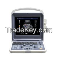 Cansonic portable ultrasound scanner machine
