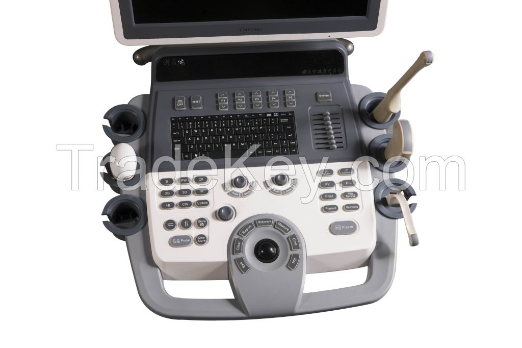 Full Digital Ultrasound Scanner K18