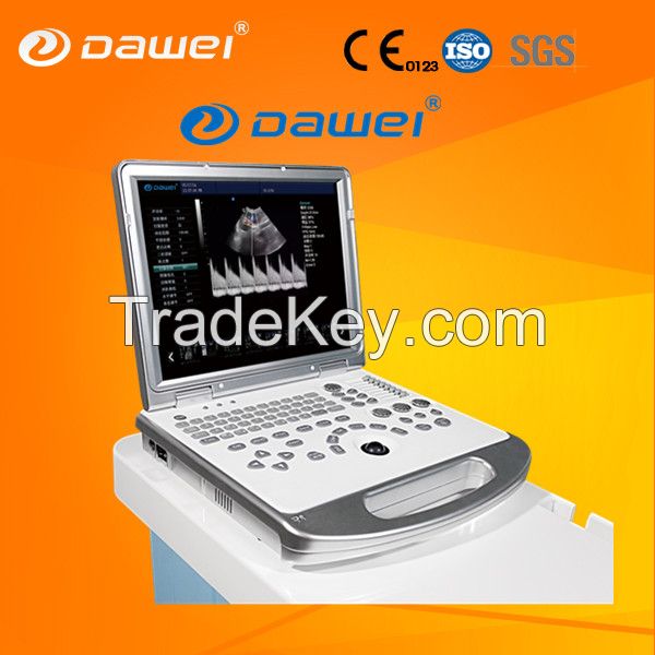 3D color doppler ultrasound low price & windows based ultrasound machine