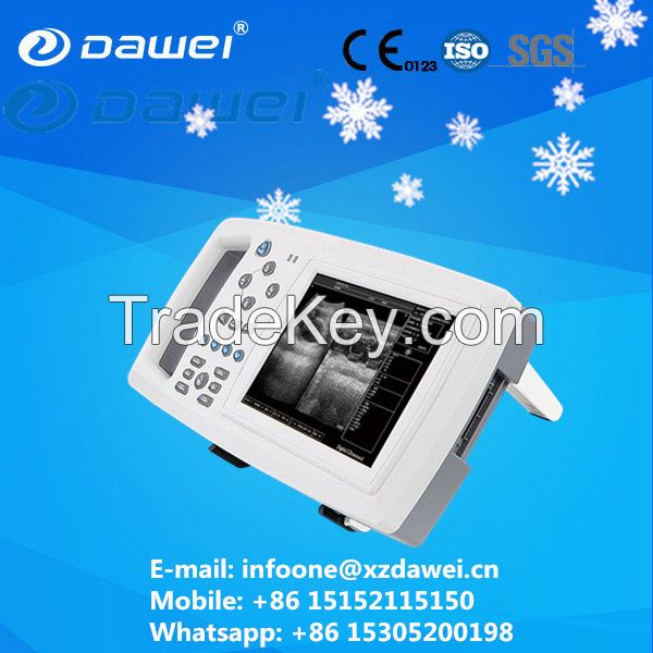DW600 handheld ultrasound scanner/ultrasound machine
