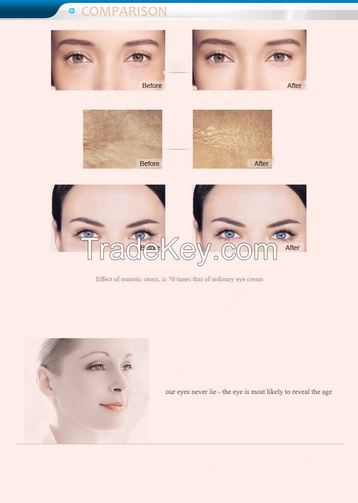 ZhiFangYuan Effective Eye Care Essential Oil Removal of Dark Circles