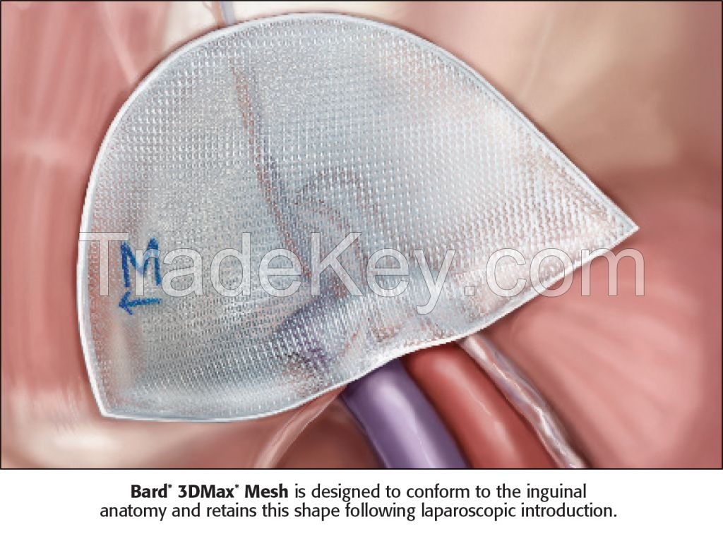 3D MAX MESH HERNIA