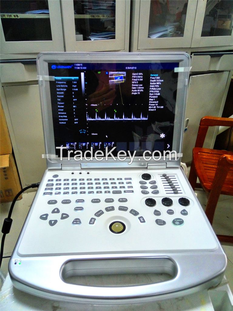 portable color doppler ultrasound scanner