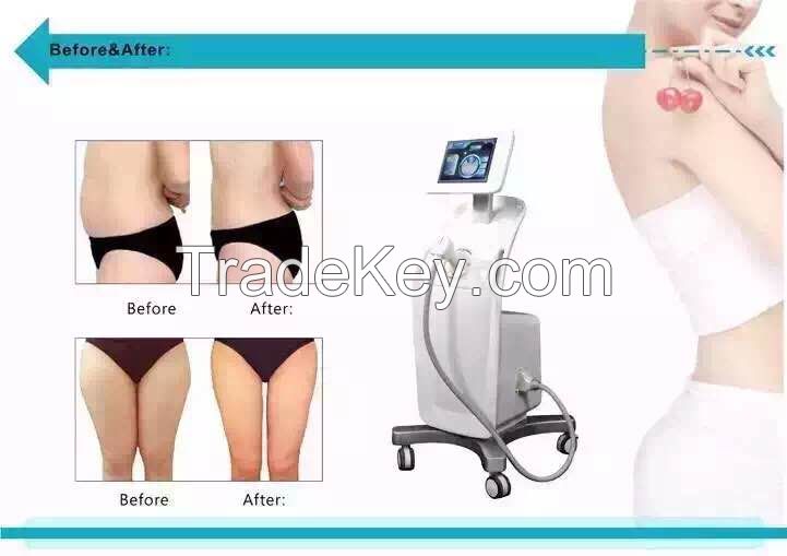 Liposunix Hifu Body Slimming Machine