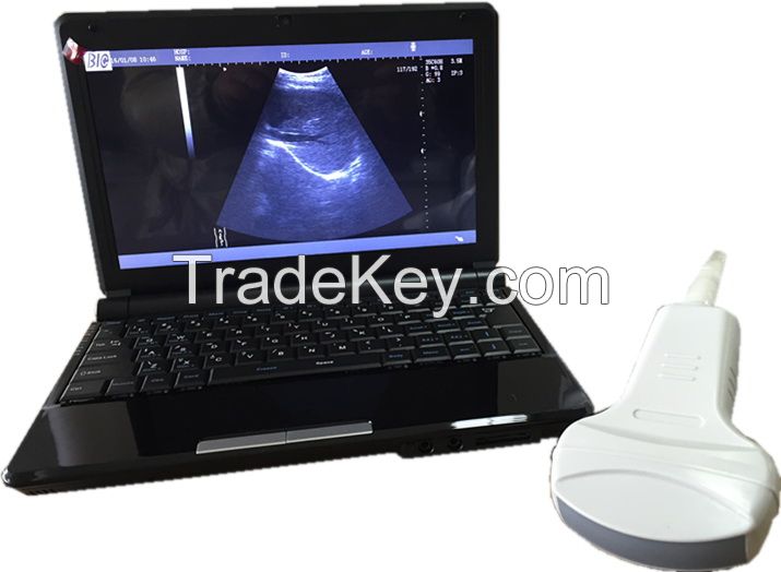 10.1" TFT LED Ultrasound Scanner with Convex Linear Transvaginal Micro Convex Probe