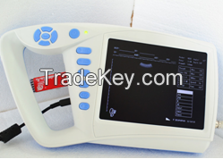 Mini-smart Full Digital Palm Ultrasound Scanner with CE/ISO human use(ATNL/51353C)