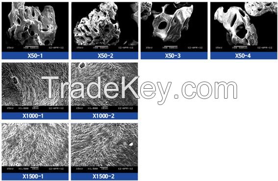 Bovine Bone for Dental Implant