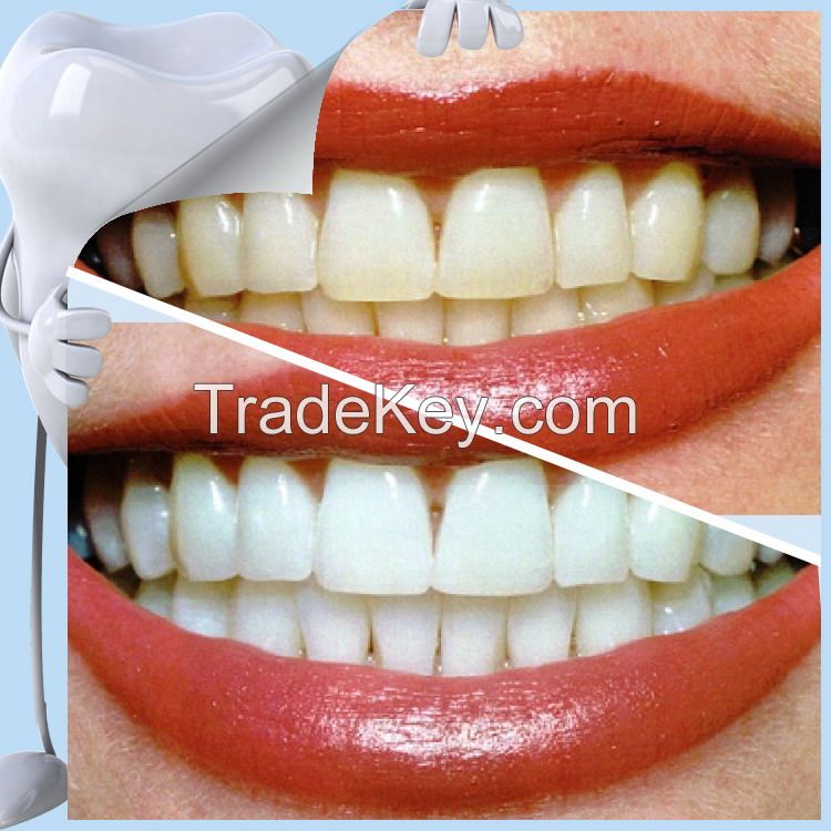 Manufacturer Want instatant Teeth Whitening Kit shareusmile kit