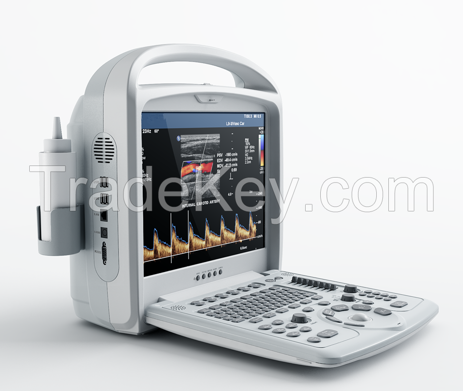 Ysd280 3d/4d Color Doppler Digital Portable Ultrasound Scanner