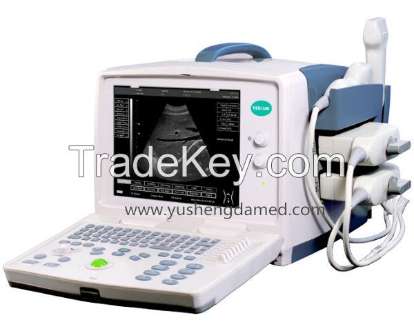 Full Digital Portable B Mode Ultrasound Scanner