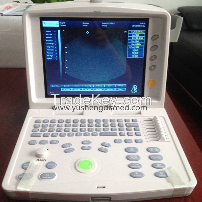 CE ISO Approved Full Digital Ultrasound Scanner