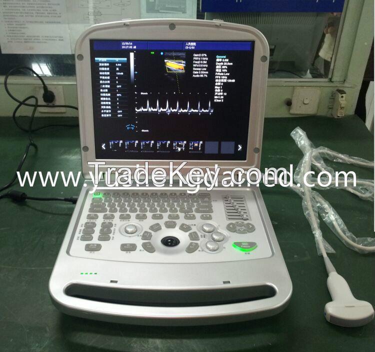 Digital 3d/4d Digital Laptop Color Doppler Ultraound Scanner