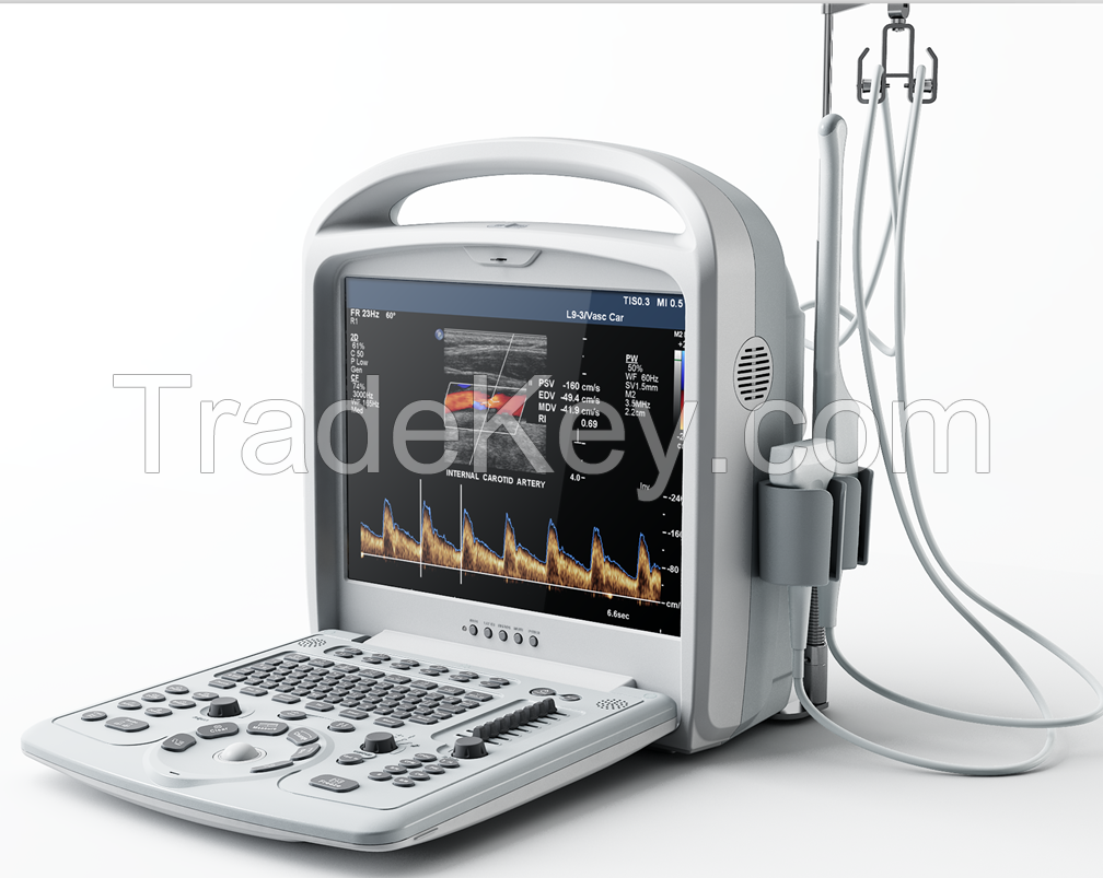 YSD280 3D/4D Color Doppler Digital Portable Ultrasound Scanner