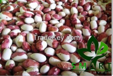 Smart Agro Invest LLC : Kidney Beans &quot;Little Red Riding Hood&quot; from Ukraine.