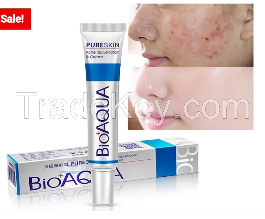 OEM 30g Bioaqua Best Pimples Removal Face Acne Treatment and Anti Acne Cream