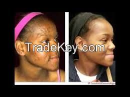 fadeaway inimate skin lightening cream +27783434273