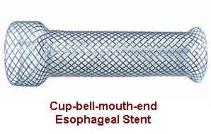 Esophageal Stent