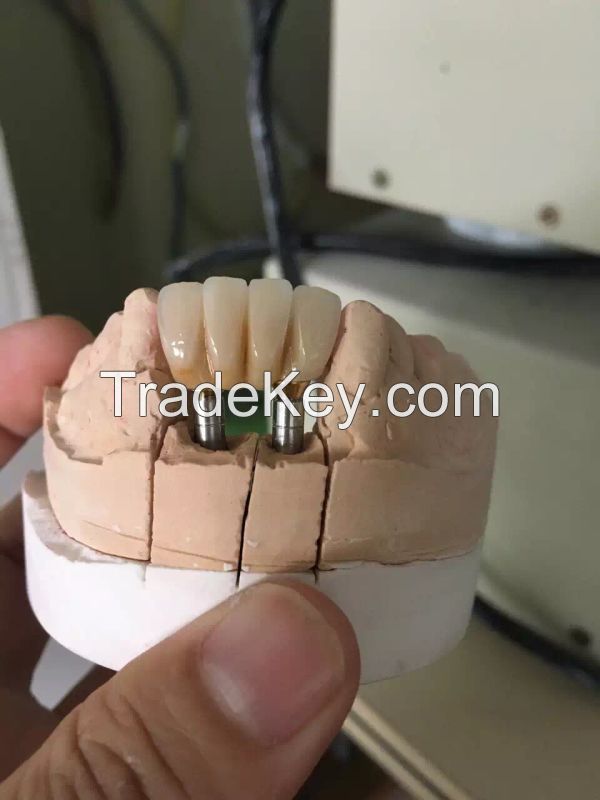 Dental zirconia block/CAD CAM milling system for dental product