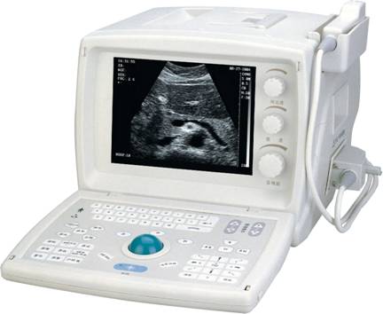 Ultrasound Scanner