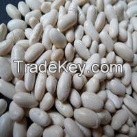 Kidney White Beans